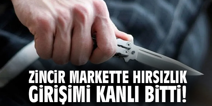 Market Soygunu Korkunç Tehditle Sona Erdi!